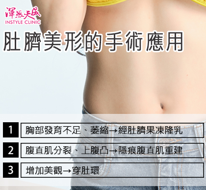 渾然天成整形醫美|肚臍美形的手術應用 渾然天成整形醫美|肚臍美形的手術應用
