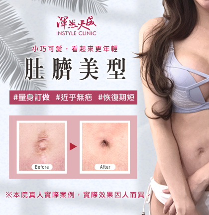 渾然天成整形醫美|肚臍也可以很性感,小巧可愛的肚臍,讓腹部看起來更年輕! 渾然天成整形醫美|肚臍也可以很性感,小巧可愛的肚臍,讓腹部看起來更年輕!
