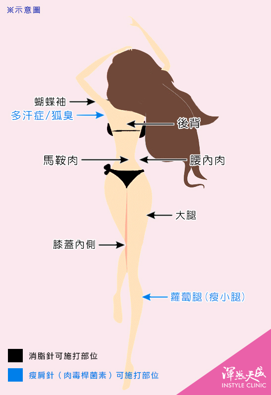 渾然天成整形醫美| 消脂針&瘦肩針(針劑除皺素)可施打哪些部位 渾然天成整形醫美| 消脂針&瘦肩針(針劑除皺素)可施打哪些部位