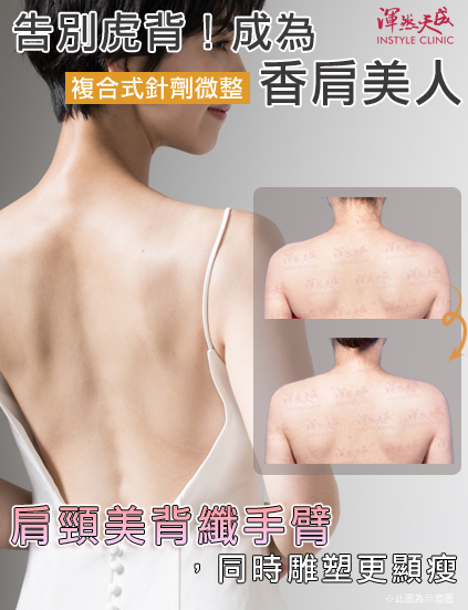 美人香肩-肌肉型、脂肪型複合式針劑微整形,肩頸美背纖手臂,同時雕塑更顯瘦。|渾然天成整形醫美 美人香肩-肌肉型、脂肪型複合式針劑微整形,肩頸美背纖手臂,同時雕塑更顯瘦。|渾然天成整形醫美