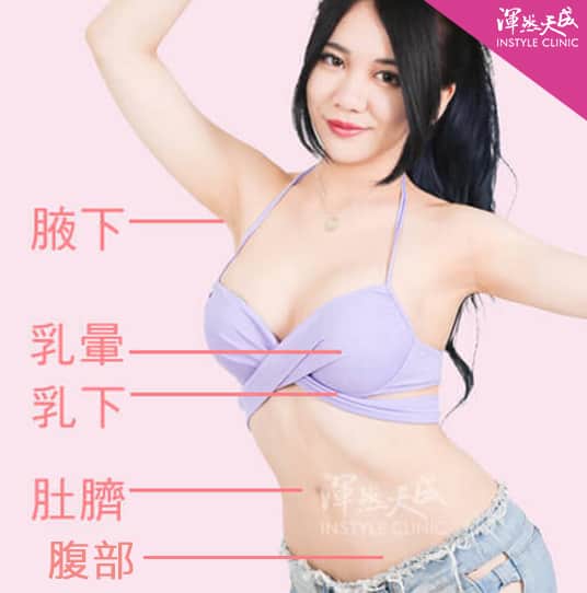 隆乳切口位置說明 隆乳切口位置說明