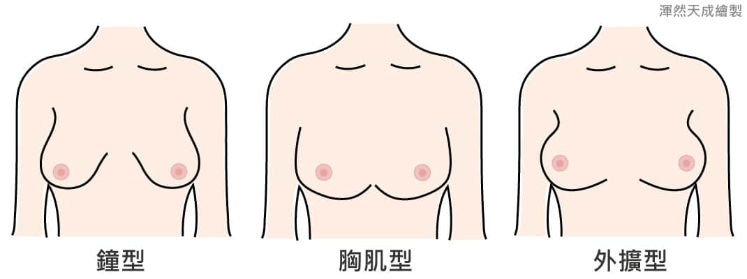渾然天成自體脂肪豐胸,幫助許多愛美者量身打造完美曲線,是您選擇自體脂肪豐胸的理想整形診所