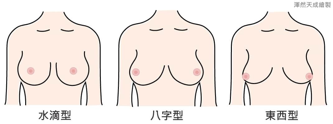 渾然天成自體脂肪豐胸,幫助許多愛美者量身打造完美曲線,是您選擇自體脂肪豐胸的理想整形診所