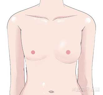 自體脂肪豐胸說明-填補前胸部模擬插圖