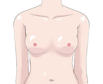 自體脂肪豐胸說明，一般認為好看的胸部模擬插圖