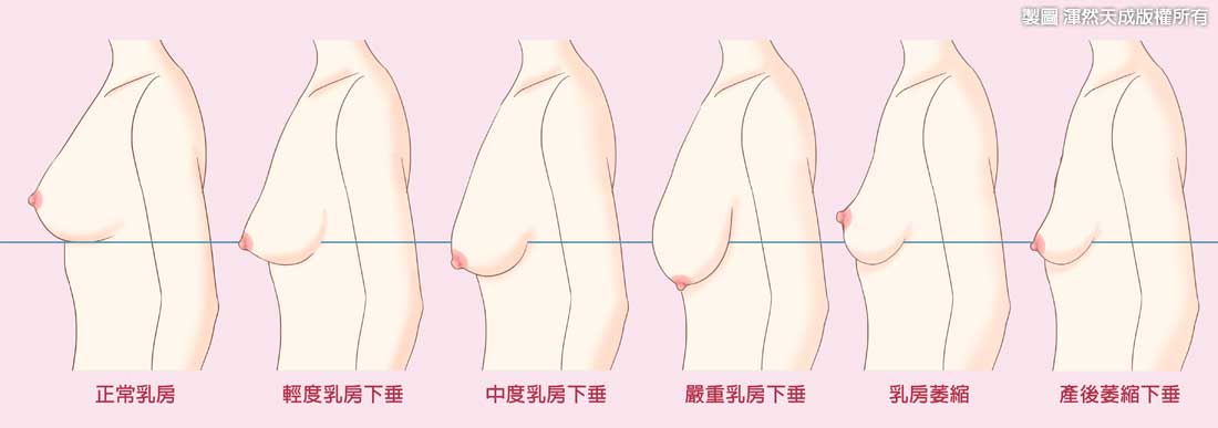 生完孩子后乳房图片