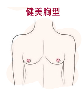 渾然天成整形醫美|Mentor曼陀水滴隆乳-各種常見胸型