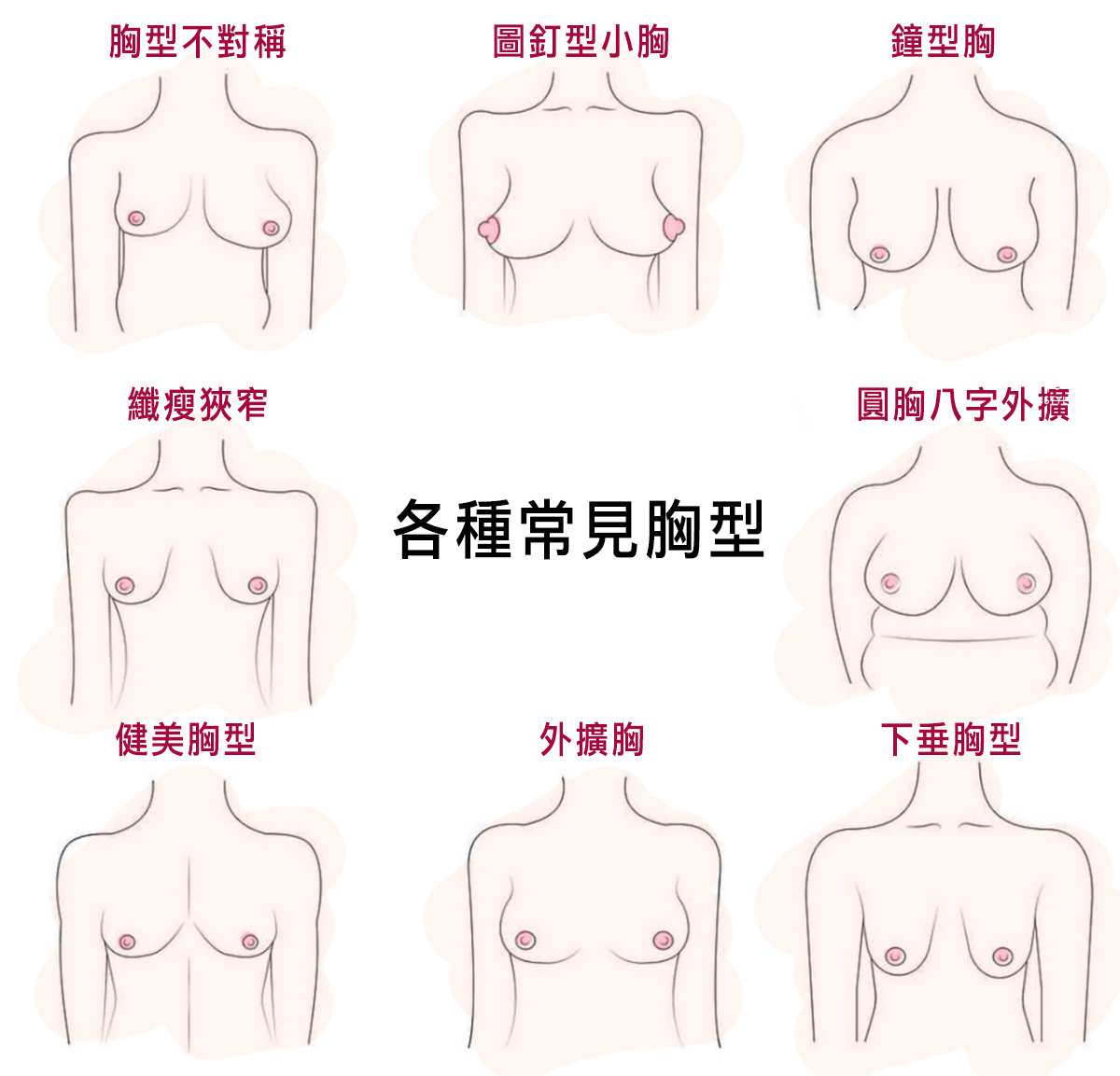 渾然天成整形醫美|Mentor曼陀水滴隆乳-高規格先進設備、醫療品質管理