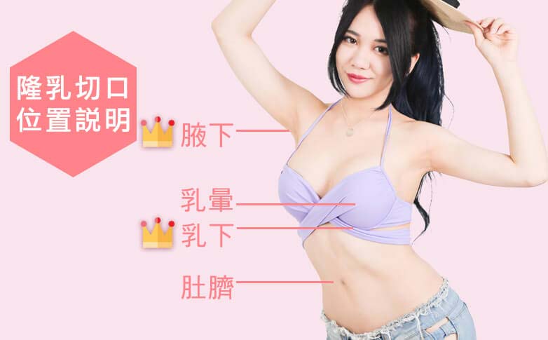 如何選擇隆乳材質與術式呢？