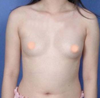 骨骼較粗大、直腰、乳頭高低差 骨骼較粗大、直腰、乳頭高低差