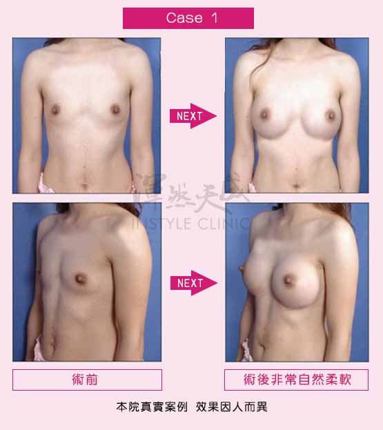渾然天成醫師評估 渾然天成醫師評估