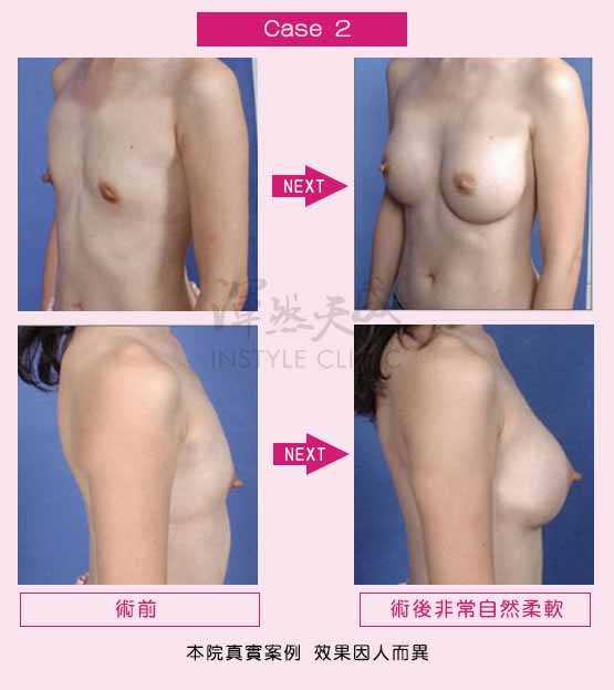 渾然天成醫師評估 渾然天成醫師評估