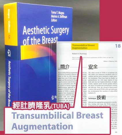 經肚臍隆乳由來 經肚臍隆乳由來