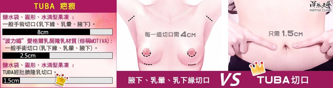 渾然天成經肚臍隆乳疤痕隱形 渾然天成經肚臍隆乳疤痕隱形