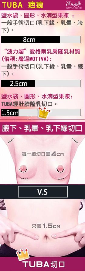 渾然天成經肚臍隆乳疤痕隱形 渾然天成經肚臍隆乳疤痕隱形