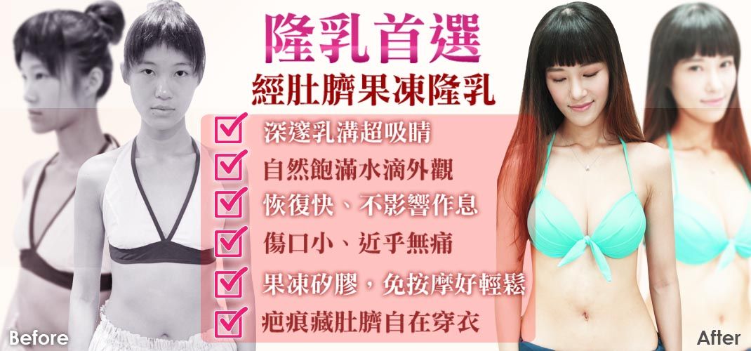 優質隆乳首選:渾然天成經肚臍果凍隆乳
