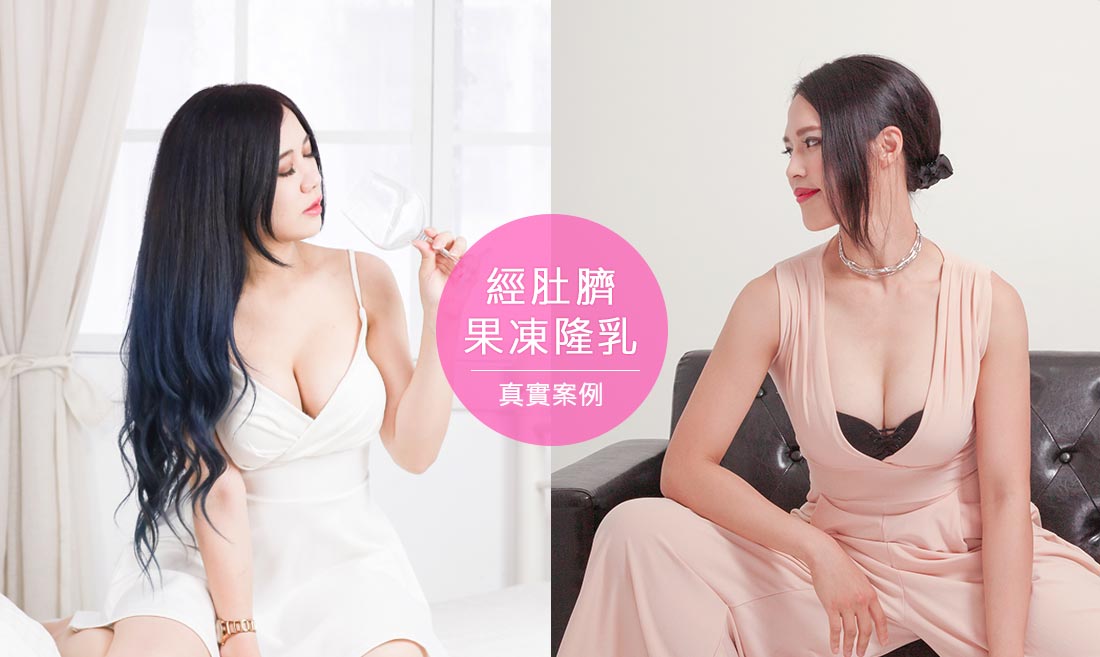 肚臍果凍矽膠隆乳渾然天成真實案例 肚臍果凍矽膠隆乳渾然天成真實案例