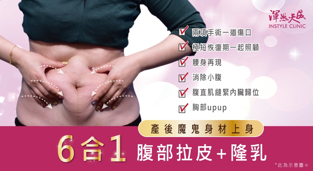 隆乳,隆乳費用,隆乳心得,隆乳手術,隆乳效果,隆乳哺乳,隆乳推薦,水滴型隆乳,果凍隆乳,內視鏡隆乳,經肚臍隆乳,經肚臍隱形隆乳