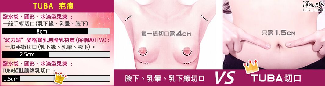 各種隆乳手術切口大小比較 隆乳切口大小比較