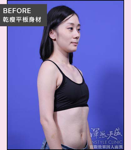 豐胸,隆乳,隆乳實錄,隆乳心得,隆乳效果,豐胸辦法,平胸困擾 經肚臍果凍,隱形隆乳,渾然天成,陳淑賢醫師,女醫團隊,醫師,推薦,豐胸,平胸,小奶,飛機場,貧乳,肚臍,傷口小,恢復快,立即,效果好,自然,乳溝,三圍,水滴,柔軟,內衣,小可愛,運動,集中型內衣,術後,失敗,問題,照顧,中醫,針灸,酒釀蛋,拍打,按摩,D奶,E奶,深V,成功,飽滿,圓潤,女神,假奶正妹