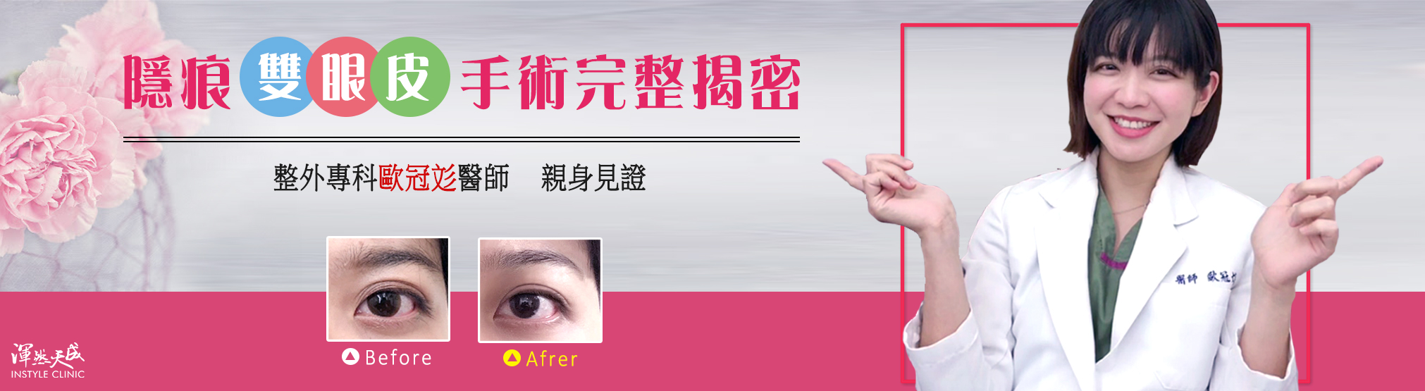 渾然天成整形醫美-雙眼皮-醫師也有整型需求？告別無神、大小眼