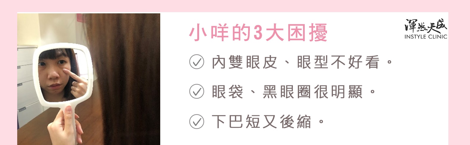 渾然天成整形醫美-小咩的3大困擾:1.內雙眼皮、眼型不好看 2.眼袋、黑眼圈很明顯 3.下巴短又後縮