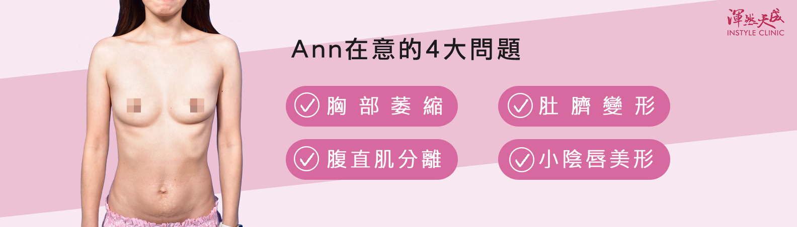 渾然天成整形醫美-Ann在意的4大問題:1.胸部萎縮 2.肚臍變形 3.腹直肌分離 4.小陰唇美形