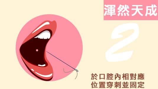 渾然天成,台北,醫美,整形,腫,推薦,消腫,酒窩,梨窩,諮詢,自然,疤痕,量身訂做,手術,麻醉,無痛,術前,術後,笑,醫師,專業,保養,費用,掉針,無疤,缺點,恢復期,臉部肌肉,肌肉,臉部,價格,價錢,費用,凹洞,失敗,微整,微整型,ptt,種類,位置