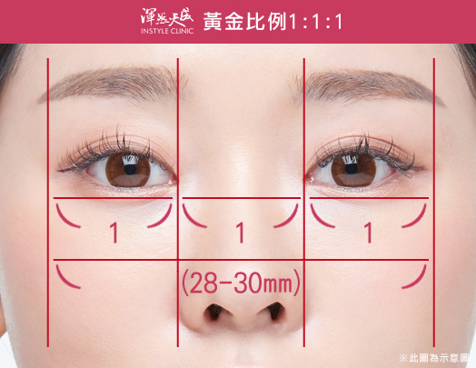 開眼頭黃金比例1:1:1|渾然天成整形醫美 開眼頭黃金比例1:1:1|渾然天成整形醫美。