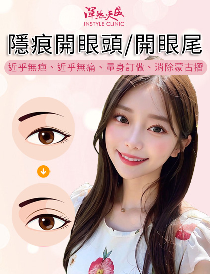 隱痕開眼頭/開眼尾,近乎無疤、近乎無痛、量身訂做、消除蒙古摺|渾然天成整形醫美 隱痕開眼頭/開眼尾,近乎無疤、近乎無痛、量身訂做、消除蒙古摺|渾然天成整形醫美