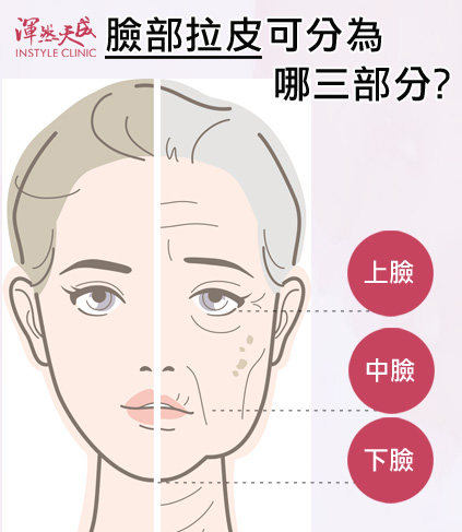 臉部拉皮可分為:上臉、中臉、下臉|渾然天成整形醫美 臉部拉皮可分為:上臉、中臉、下臉|渾然天成整形醫美。