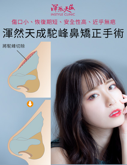 渾然天成駝峰鼻矯正手術|渾然天成整形醫美 渾然天成駝峰鼻矯正手術|渾然天成整形醫美