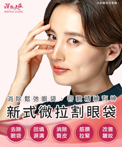 新式微拉割眼袋,去除眼袋、回填淚溝、消除贅皮、筋膜拉緊、改善皺紋|渾然天成整形醫美 新式微拉割眼袋,去除眼袋、回填淚溝、消除贅皮、筋膜拉緊、改善皺紋|渾然天成整形醫美