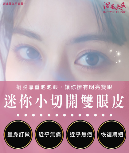 迷你小切開雙眼皮,泡泡眼剋星,量身訂做、近乎無痛、近乎無疤、恢復期短。|渾然天成整形醫美 迷你小切開雙眼皮,泡泡眼剋星,量身訂做、近乎無痛、近乎無疤、恢復期短。|渾然天成整形醫美
