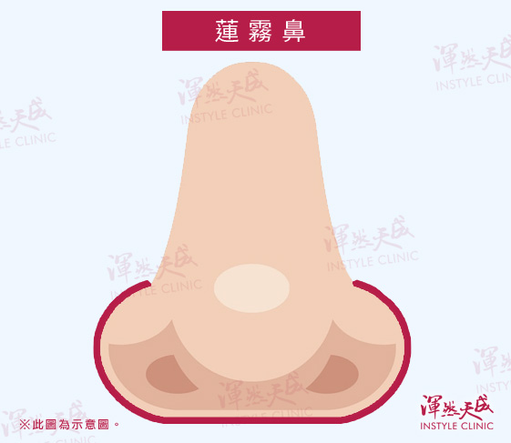 蓮霧鼻|渾然天成整形醫美 蓮霧鼻|渾然天成整形醫美