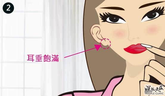 玻尿酸填補 玻尿酸填補