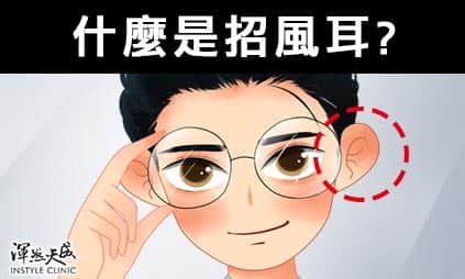 耳部整形-什麼是招風耳 耳部整形-什麼是招風耳