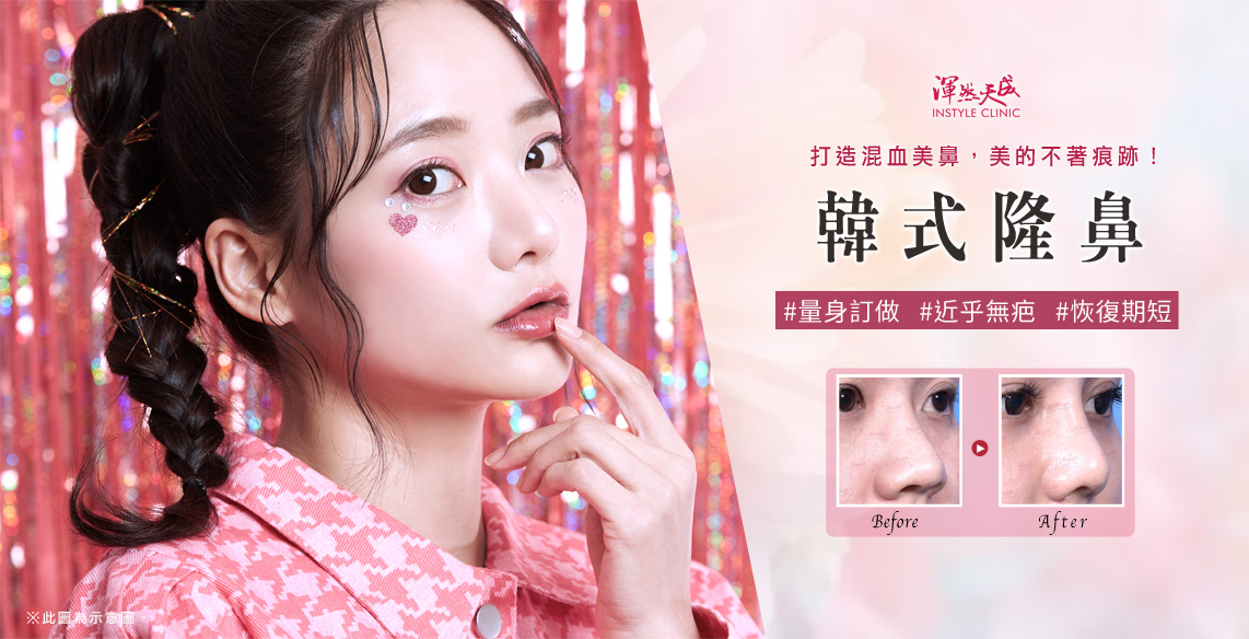 渾然天成,整形,醫美,鼻,隆鼻,費用,價格,價錢,價位,台北,山根,軟骨,術前,術後,手術,材質,消腫,恢復期,失敗,後遺症,ptt,推薦,人工骨,方式,傷口,痕跡,蒜頭鼻,朝天鼻,價位,脂肪,鼻樑,鼻頭,疤痕,影響,麻醉,淺舒眠麻醉＋鎮定止痛＋局部麻醉,皮下,骨膜下,L型,I型,內開,外開,鼻模,鼻翼