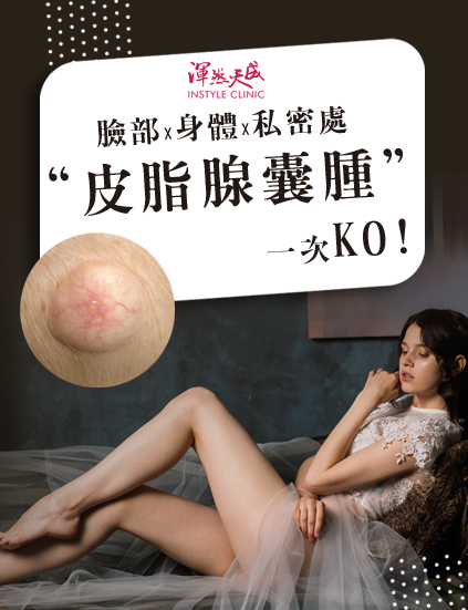 皮脂腺囊腫,泛稱為「粉瘤」,臉部、身體、私密處,粉瘤痘痘一次KO|渾然天成整形醫美 皮脂腺囊腫,泛稱為「粉瘤」,臉部、身體、私密處,粉瘤痘痘一次KO|渾然天成整形醫美