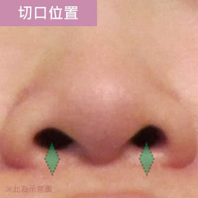 切口位置 切口位置