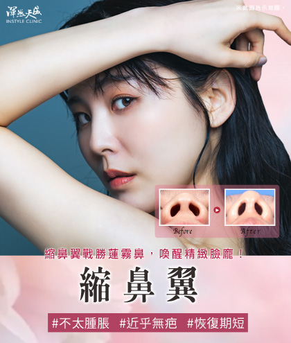 縮鼻翼戰勝蓮霧鼻,喚醒精緻臉龐!近乎無疤、不太腫脹、恢復期短|渾然天成整形醫美 縮鼻翼戰勝蓮霧鼻,喚醒精緻臉龐!近乎無疤、不太腫脹、恢復期短|渾然天成整形醫美