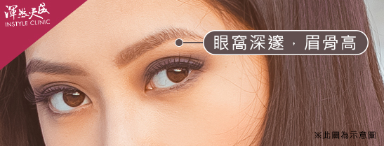 渾然天成整形醫美-眼窩深邃,眉骨高:多數外國人有的特徵,眉骨能將眼窩打造出一種陰影效果與立體感。 渾然天成整形醫美-眼窩深邃,眉骨高:多數外國人有的特徵,眉骨能將眼窩打造出一種陰影效果與立體感。