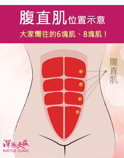 渾然天成整形醫美|隱痕腹直肌重建-就是大家嚮往的6塊肌、8塊肌啦!底下包覆的就是腹直肌~ 渾然天成整形醫美|隱痕腹直肌重建-就是大家嚮往的6塊肌、8塊肌啦!底下包覆的就是腹直肌~