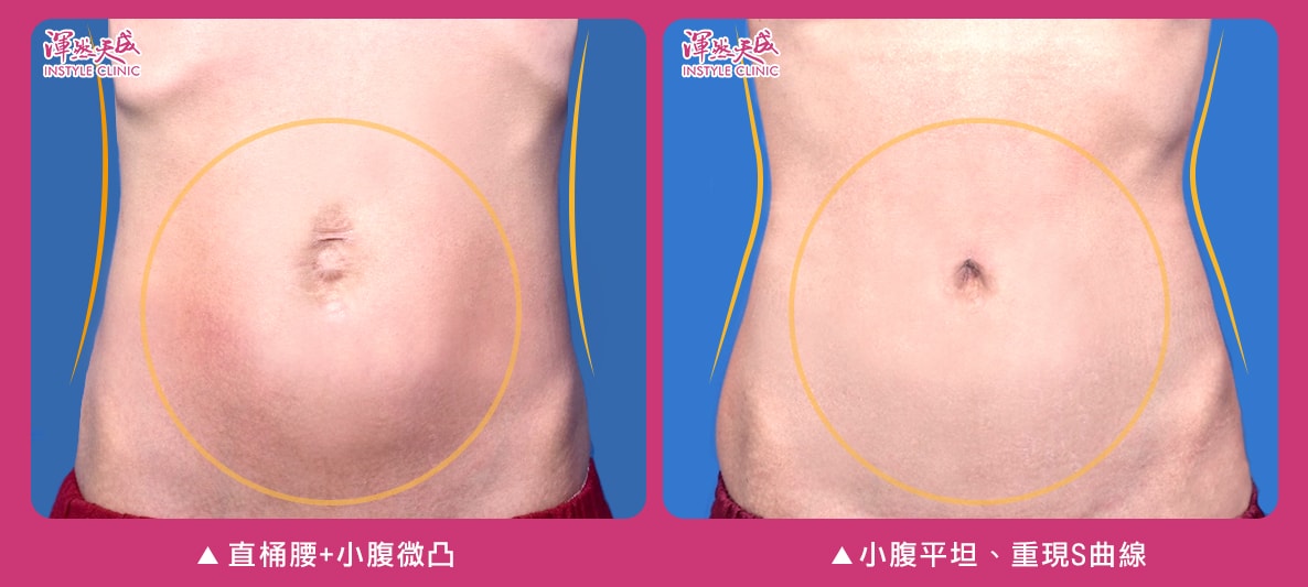渾然天成整形醫美 渾然天成整形醫美