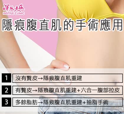 渾然天成整形醫美|隱痕腹直肌重建-需經由專業醫師評估,符合個人狀況的手術 渾然天成整形醫美|隱痕腹直肌重建-需經由專業醫師評估,符合個人狀況的手術