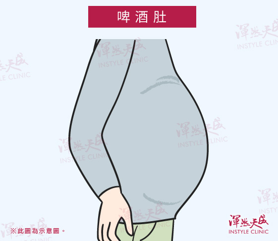 啤酒肚|渾然天成整形醫美 啤酒肚|渾然天成整形醫美