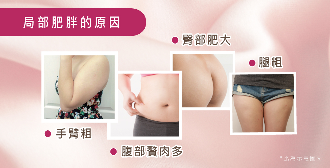 渾然天成經肚臍果凍隆乳適合怕留疤或是忙碌的族群,無論是工作需求或希望自己恢復美麗、更有自信都可以利用經肚臍果凍隆乳的優點