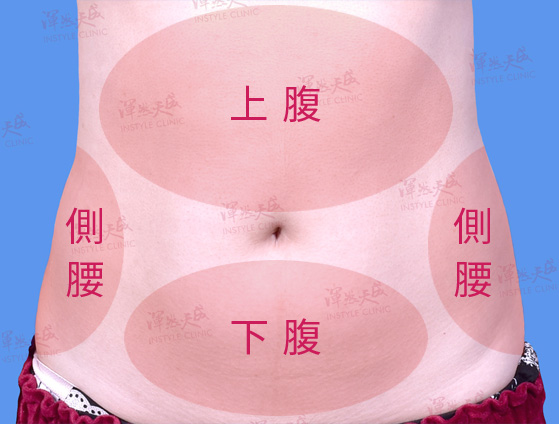 渾然天成整形醫美|腹部三合一抽脂「上腹、下腹、側腰」一次解決腹腰部多餘脂肪。 渾然天成整形醫美|腹部三合一抽脂「上腹、下腹、側腰」一次解決腹腰部多餘脂肪。