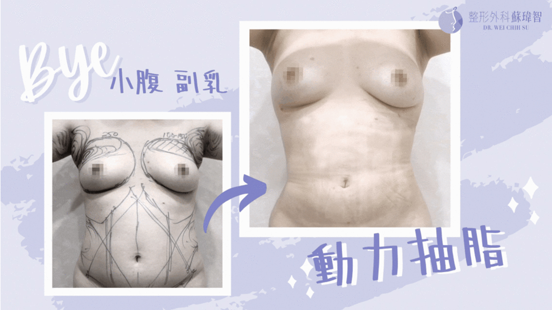 渾然天成整形醫美 渾然天成整形醫美