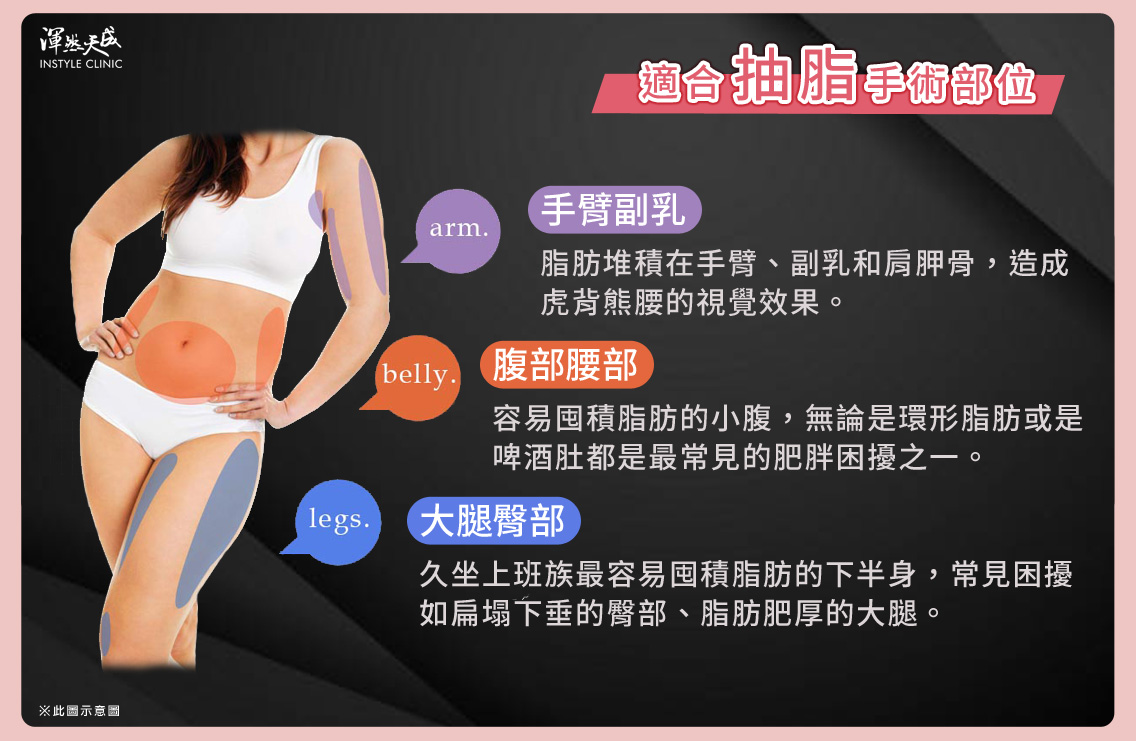 渾然天成整形醫美|適合抽脂的手術部位。 渾然天成整形醫美|適合抽脂的手術部位。